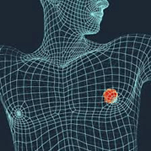 Cancer disease: Which parts of the body develop cancer first? This ...