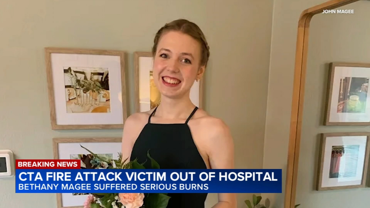 Woman set on fire on CTA Blue Line train in November is released from ...