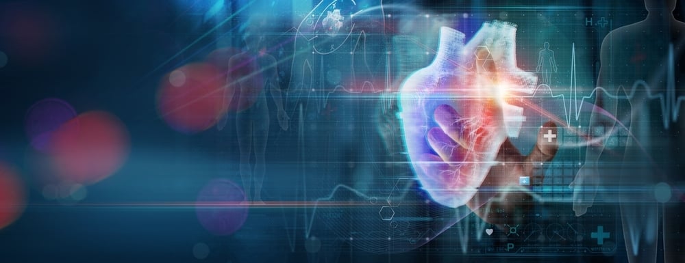 Pulse Biosciences heart device data fuels stock surge<br><br>