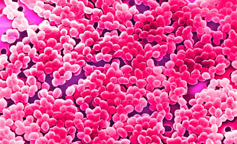 Big, bad fecal matter and enterococci scare may be ending in Florida