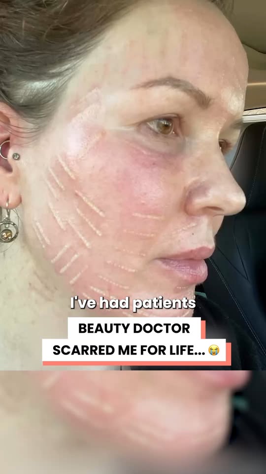 Her mistake changed my face forever