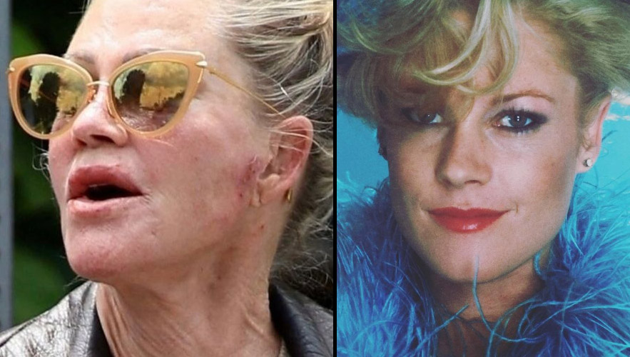 Melanie Griffith: How the ‘Working Girl’ star lives today after fame and hardship<br><br>