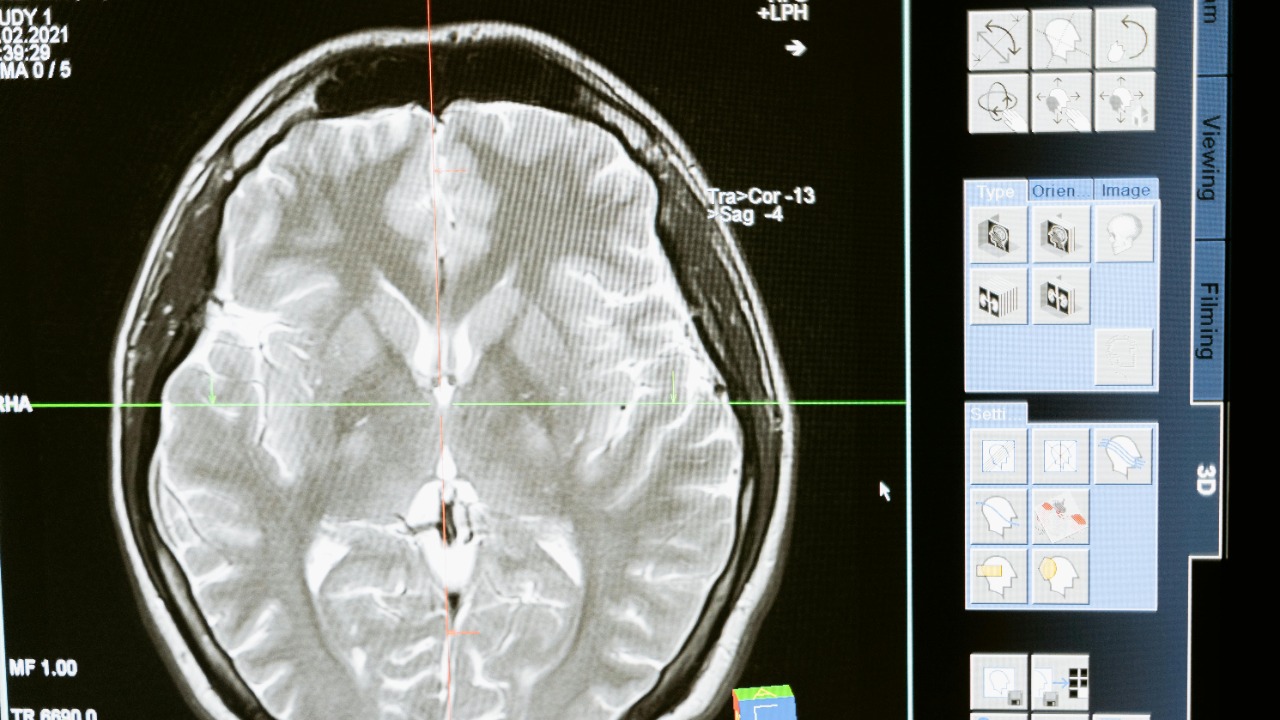 Think you’re the same person every day? This wild brain test says no