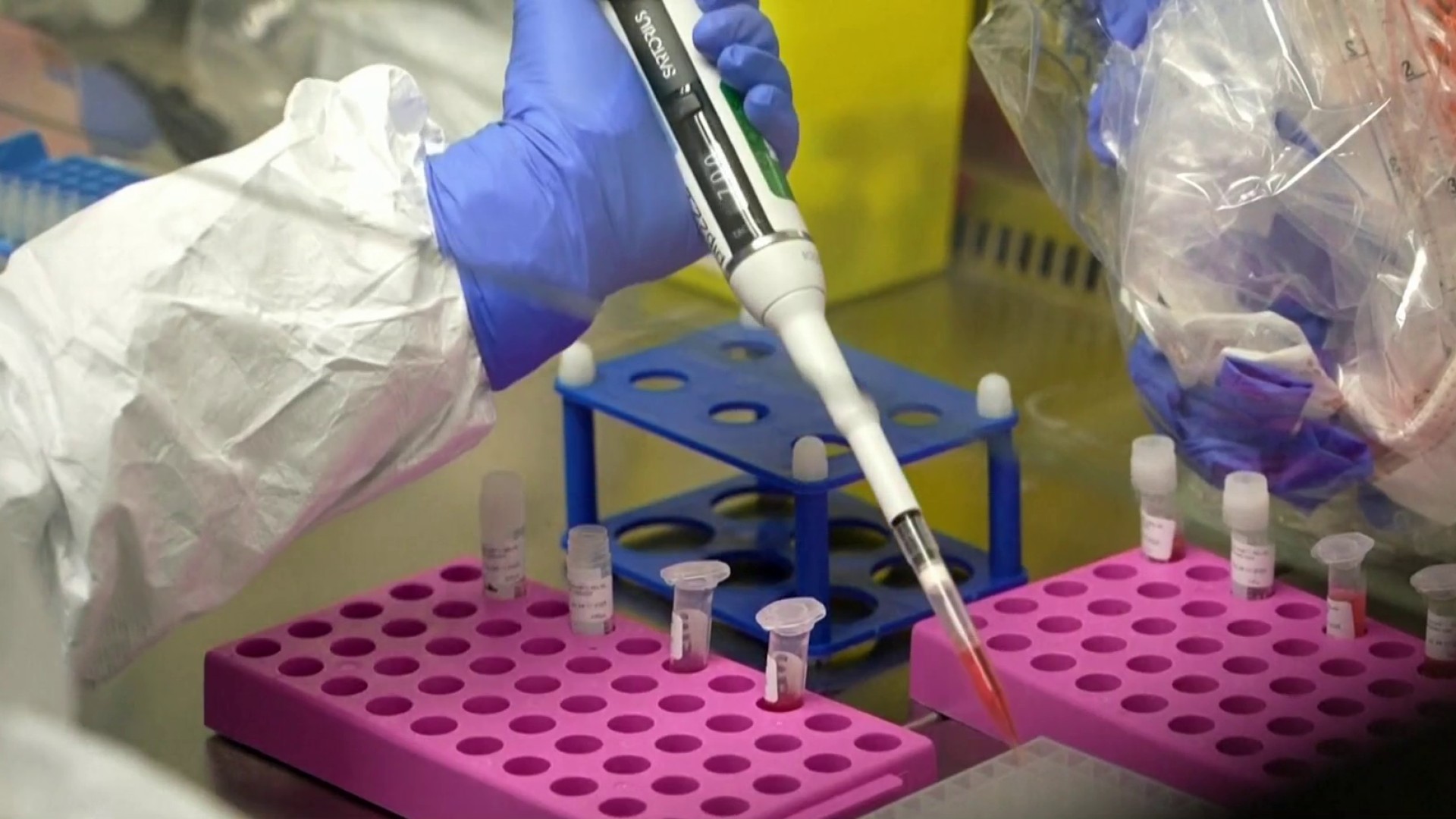 US health officials monitor deadly virus<br>