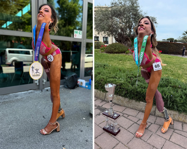 She was born without arms and a leg — now she’s inspiring millions