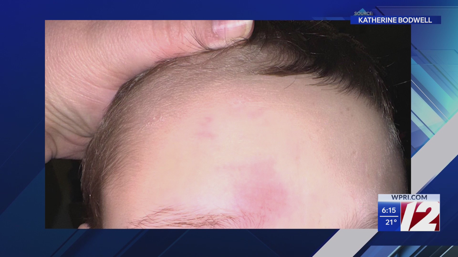 Mother says son is traumatized after alleged assault by school staffer