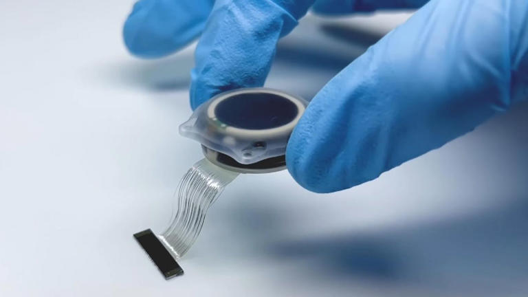 Man given Musk's brain chip in UK trial says it 'feels magical'