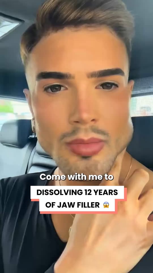 He dissolved 12 years of jaw filler