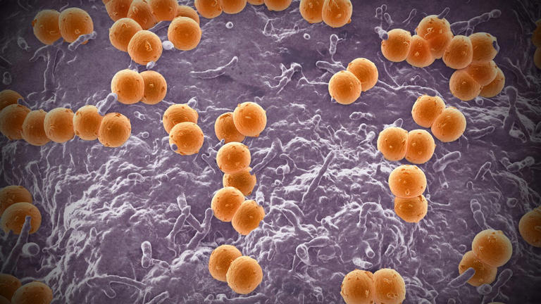 Chicago health officials report 7 cases, 2 deaths from meningitis ...