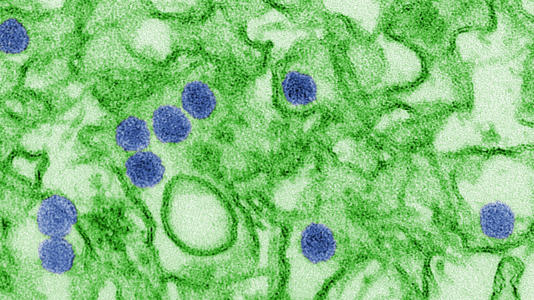 This common virus hits almost everyone, but why do only a few get crushed?