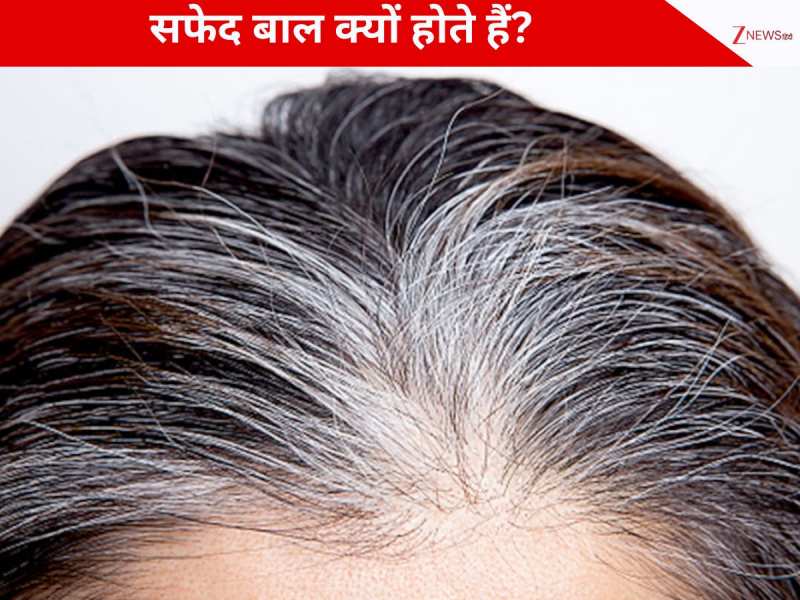 कम उम्र में क्यों होते हैं सफेद बाल, जानें इसके पीछे का कारण!