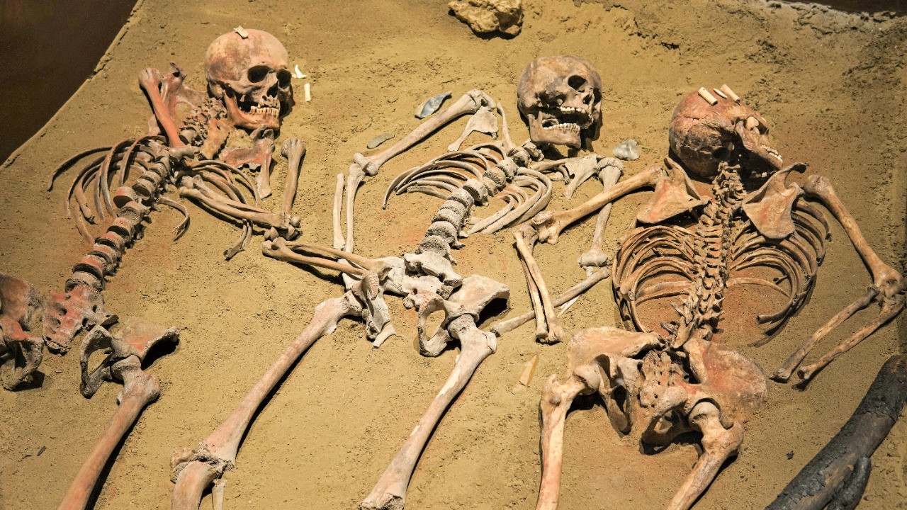 Ancient DNA uncovers 12,000-year-old case of rare genetic disorder