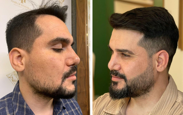 15 People Who Prove It’s Possible to Change Beyond Recognition