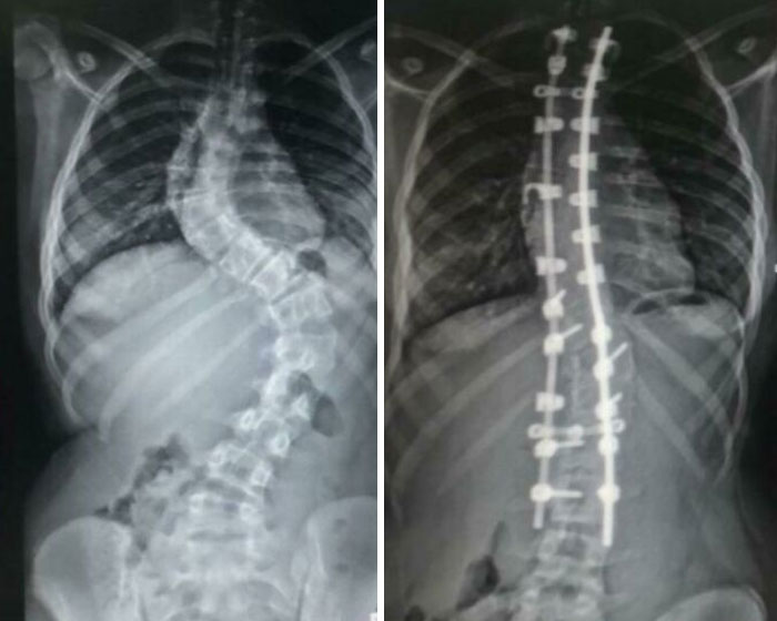 46 Of The Most Interesting Comparison Pics That Might Give You A Fresh New Perspective On Things