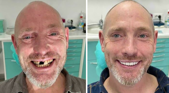 46 Of The Most Interesting Comparison Pics That Might Give You A Fresh New Perspective On Things