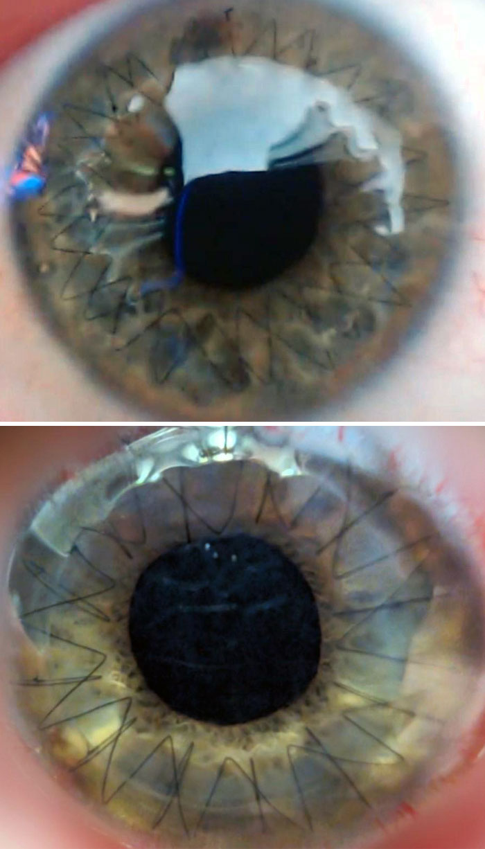 46 Of The Most Interesting Comparison Pics That Might Give You A Fresh New Perspective On Things