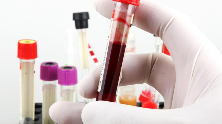 Apixaban and rivaroxaban cut serious events 69% in patients doctors ...