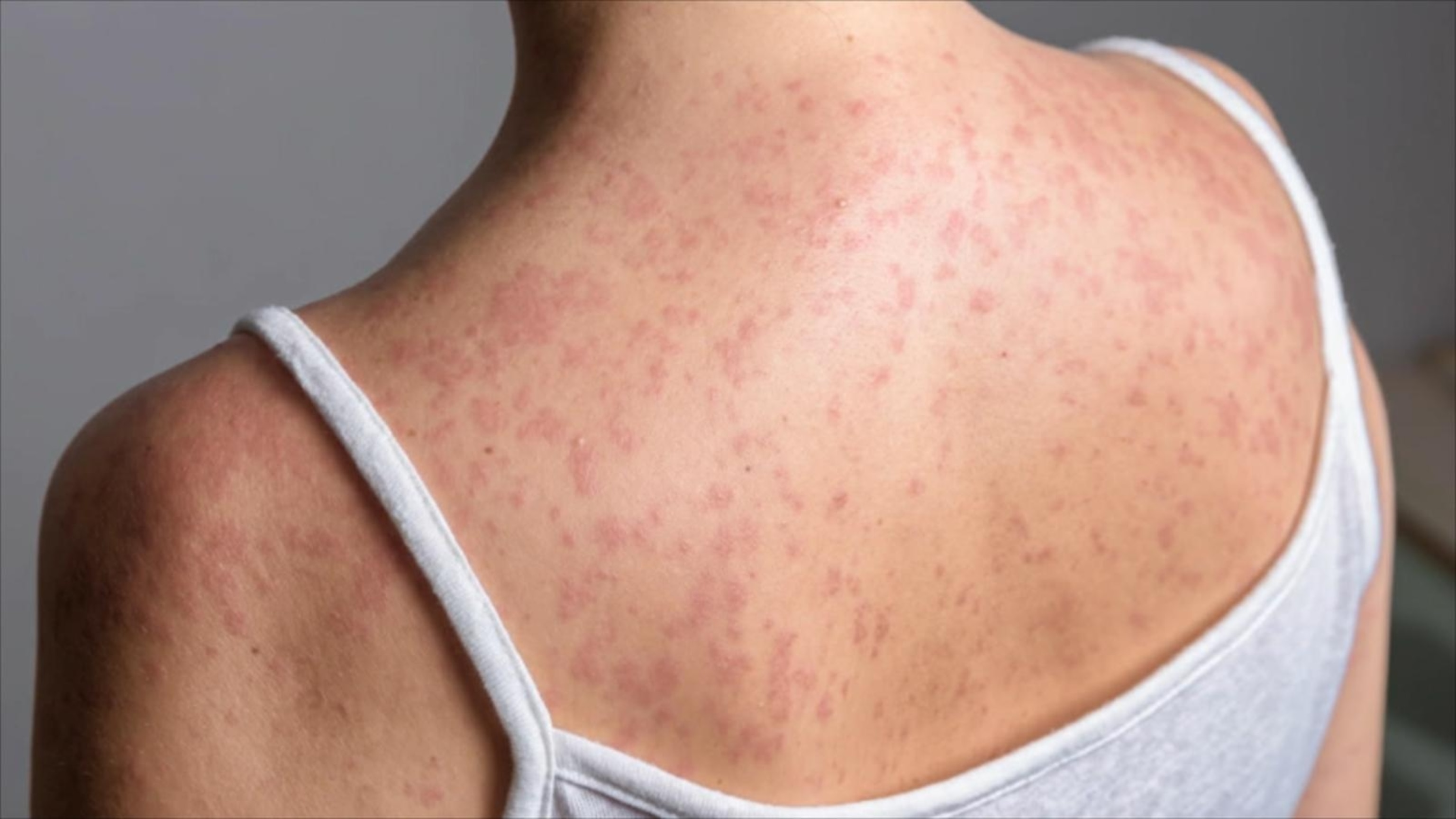 What to know about having a healthy heart<br>