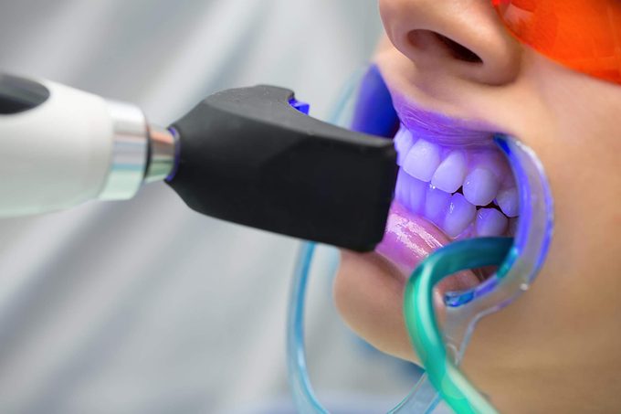 17_Whitening_Secrets-Your-Dentist-Won’t-Tell-You_364127213_bezikus