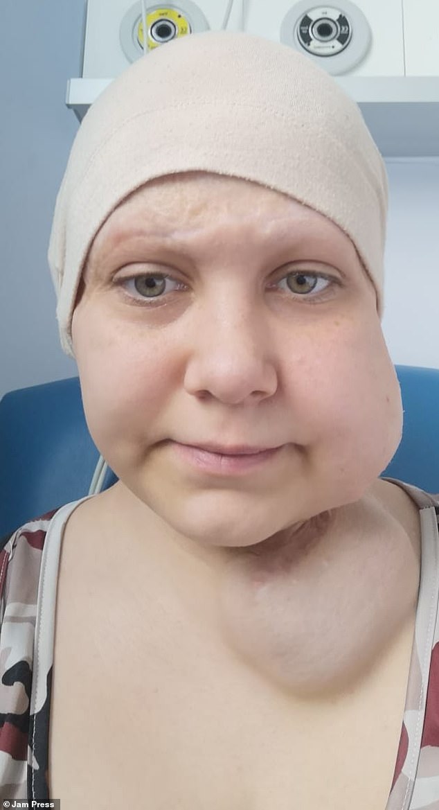 Mother, 29, left totally bald after her ponytail got caught in a ...