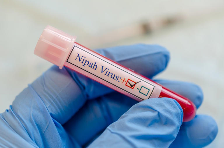 Global Virus Network issues statement on Nipah virus outbreak