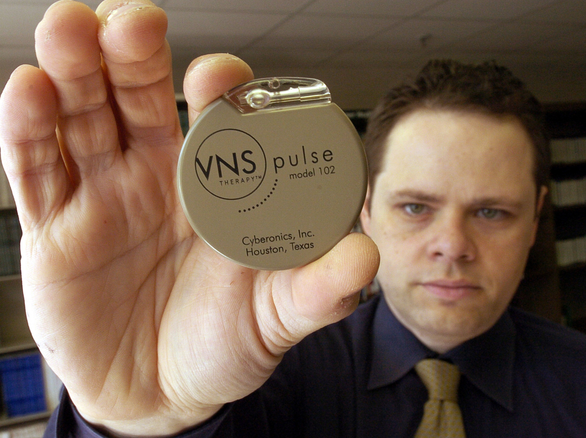 The incredible process of vagus nerve stimulation