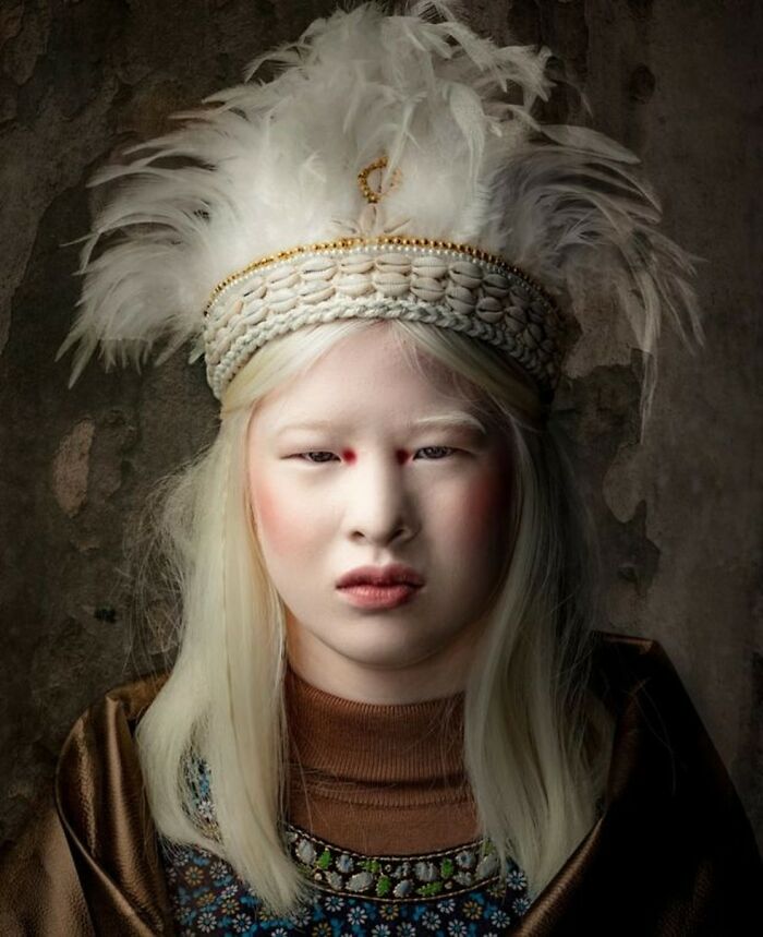 Abandoned as a baby due to albinism, Xueli grew up to become a Vogue ...