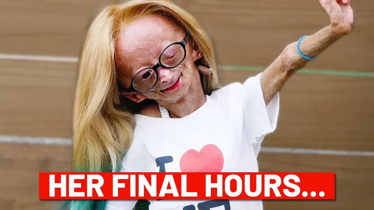 The girl who ages too fast (RIP Adalia Rose)