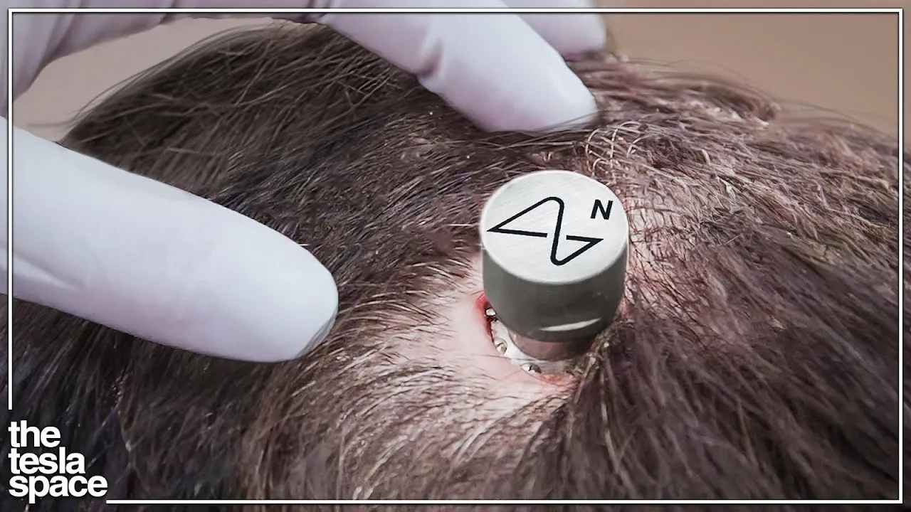 Inside Neuralink’s first human testing phase