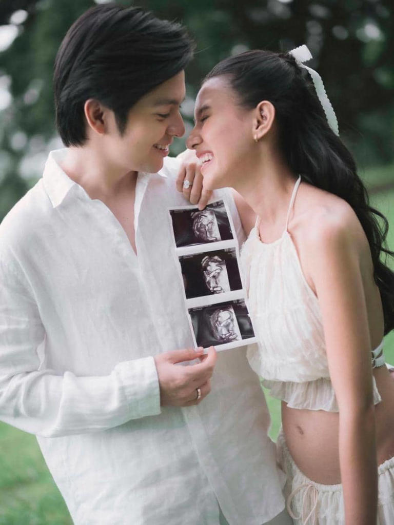 10 potret maternity shoot Angga Yunanda dan Shenina Cinnamon, bahagia!