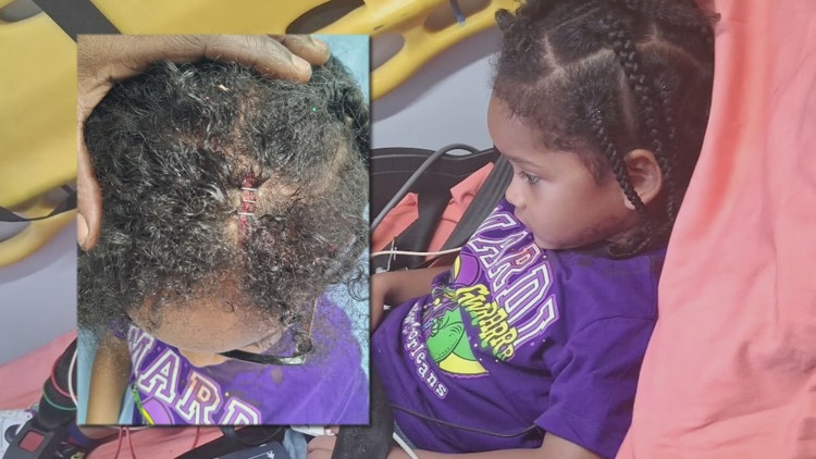 'There was blood everywhere:' Mom speaks out after 4-year-old injured ...