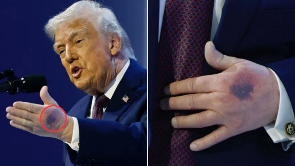 Donald Trump is 'dying' and only has 'four months to live', expert claims