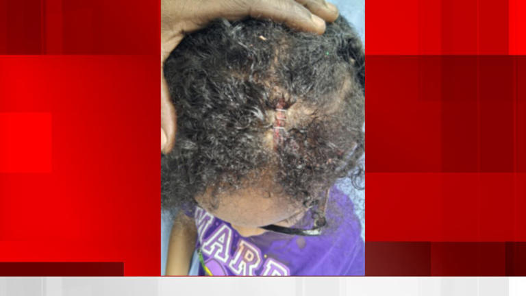Zulu ‘deeply disturbed’ by report boy was struck Tuesday by liquor ...