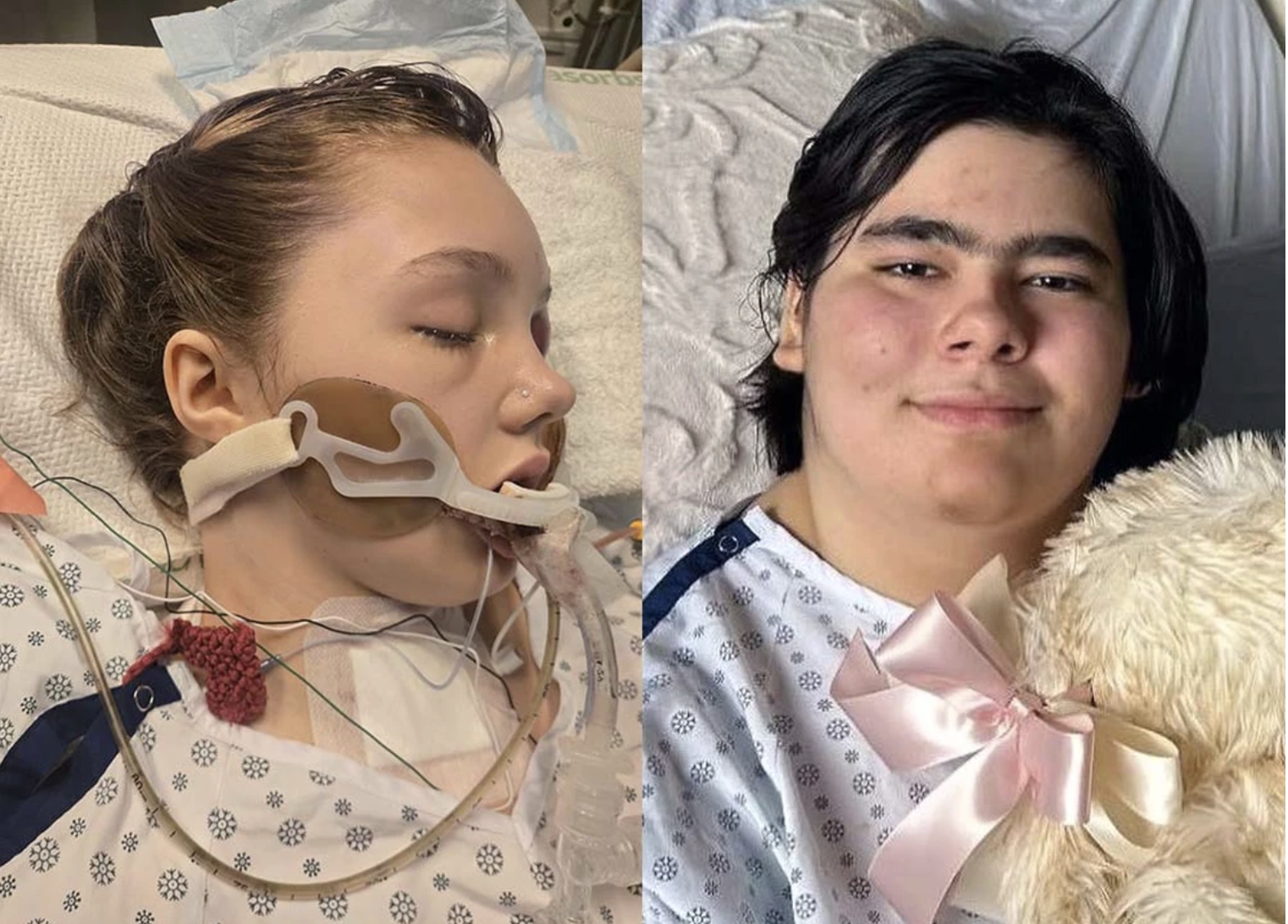 Tumbler Ridge survivors update: Maya and Paige are improving