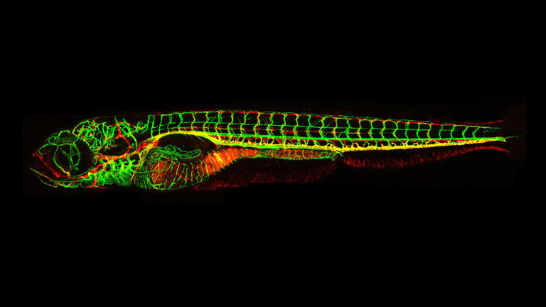 Study finds IGF speeds lymphatic vessel growth, hinting at new ...