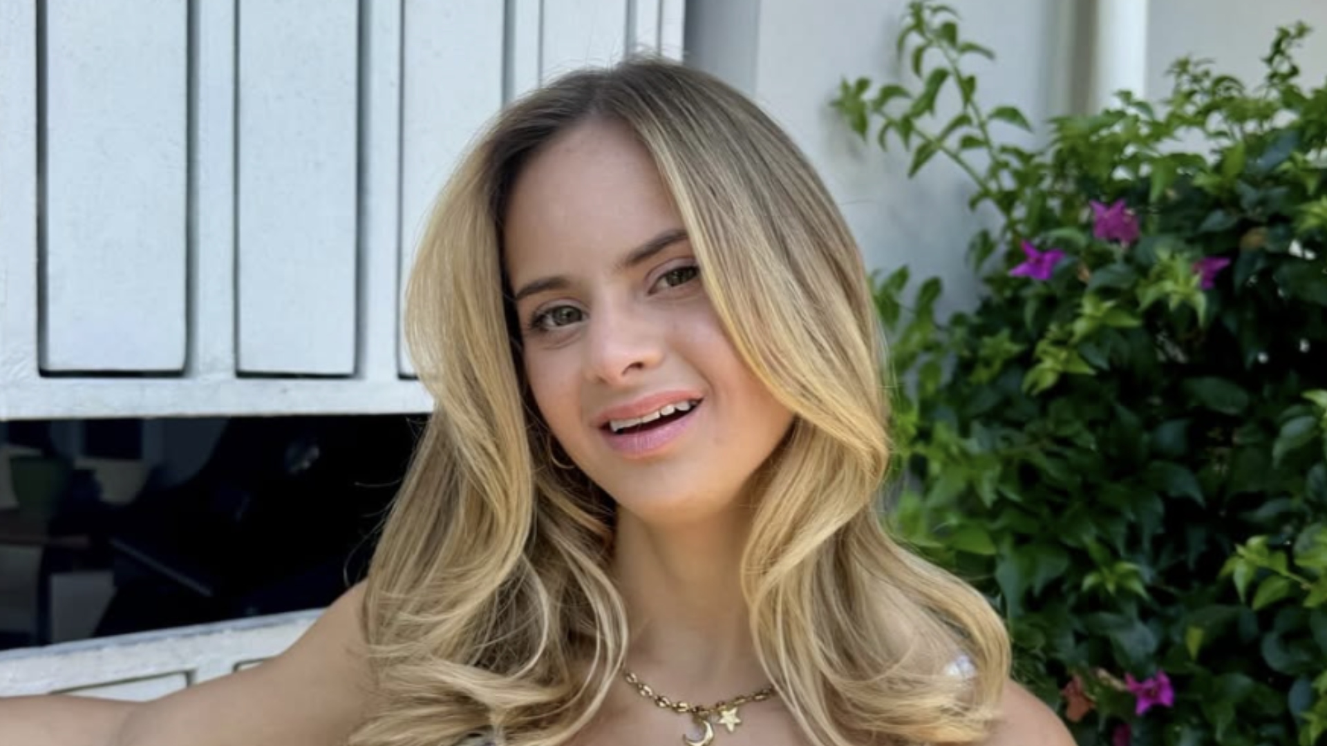 down syndrome model sofia jirau plastic surgery Image 9