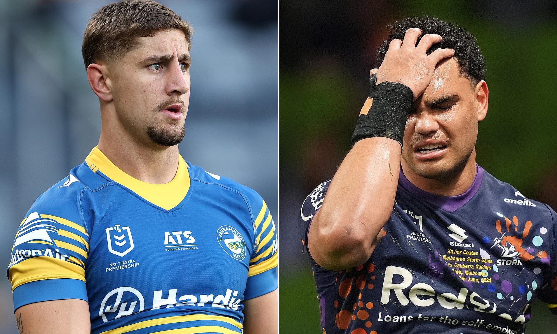Storm rocked as Coates faces three months out with Achilles injury