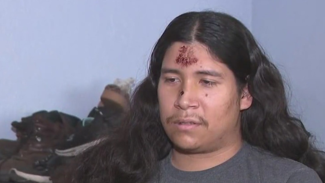 Hit-and-run victim speaks out after crash that killed family dog<br><br>