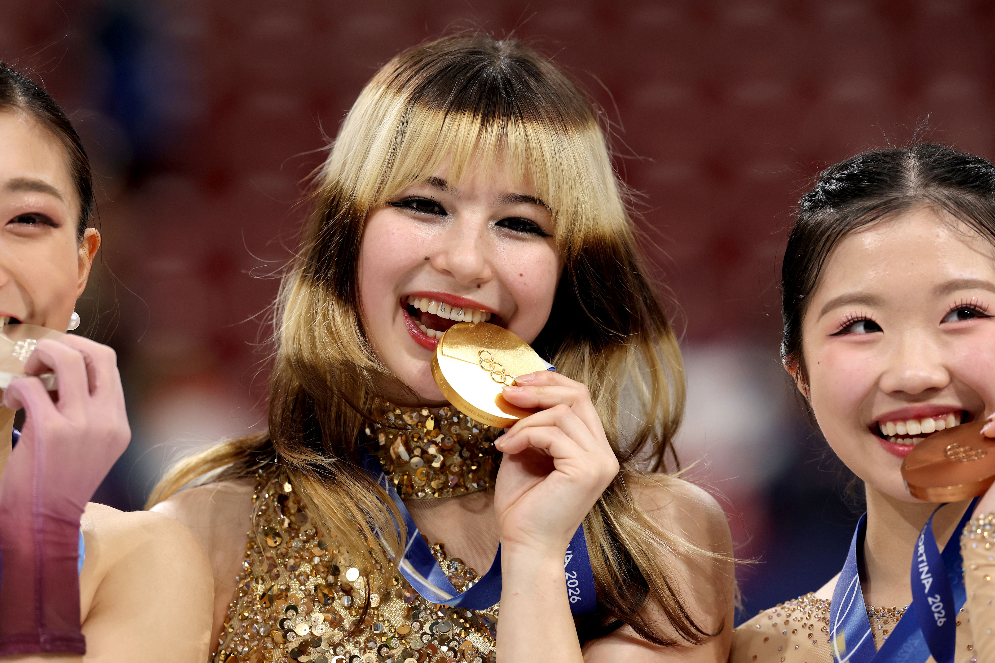 What is on Alysa Liu's front teeth? Details on the gold-medalist alt ...