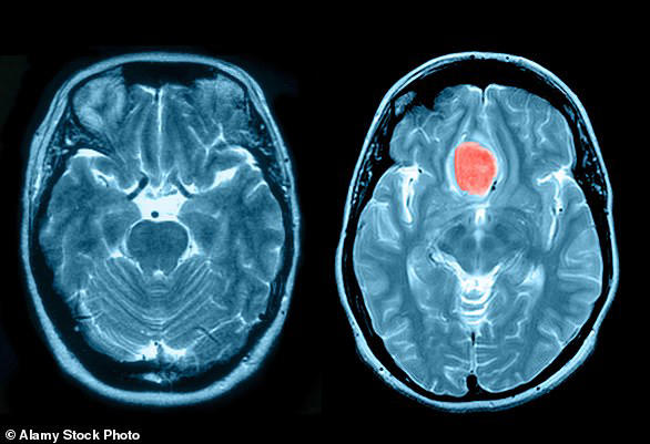Doctors told expectant mother her hearing loss was 'tinnitus' - but it ...