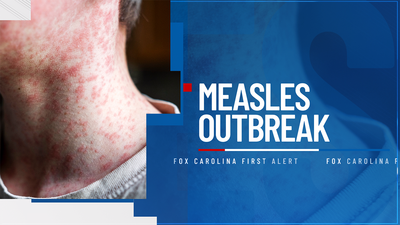 DPH: Additional school identified, 21 hospitalized in Upstate measles ...
