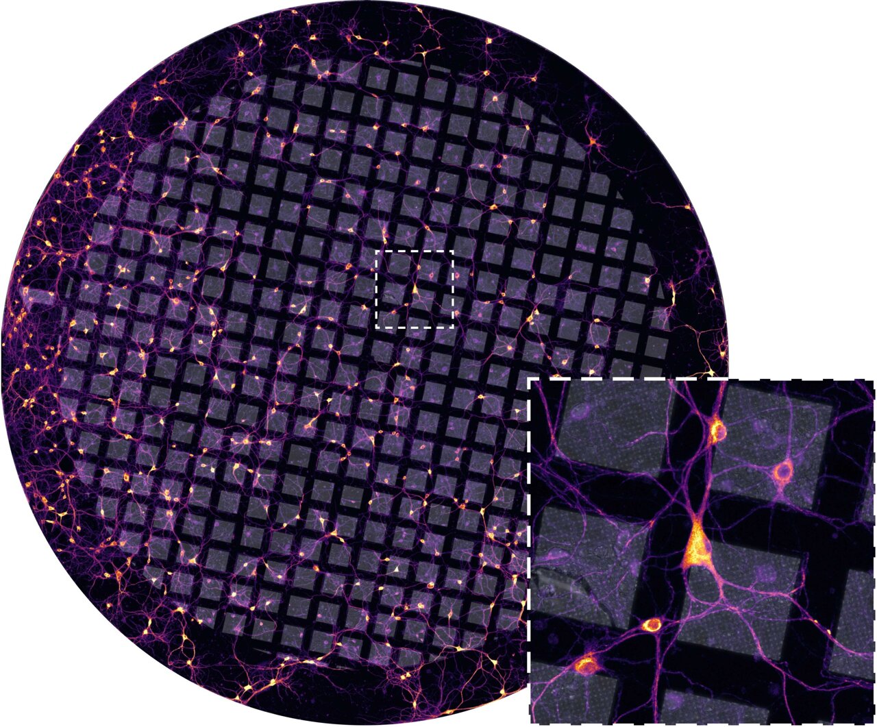 A survival strategy inside stressed cells: Ribosomes in pairs