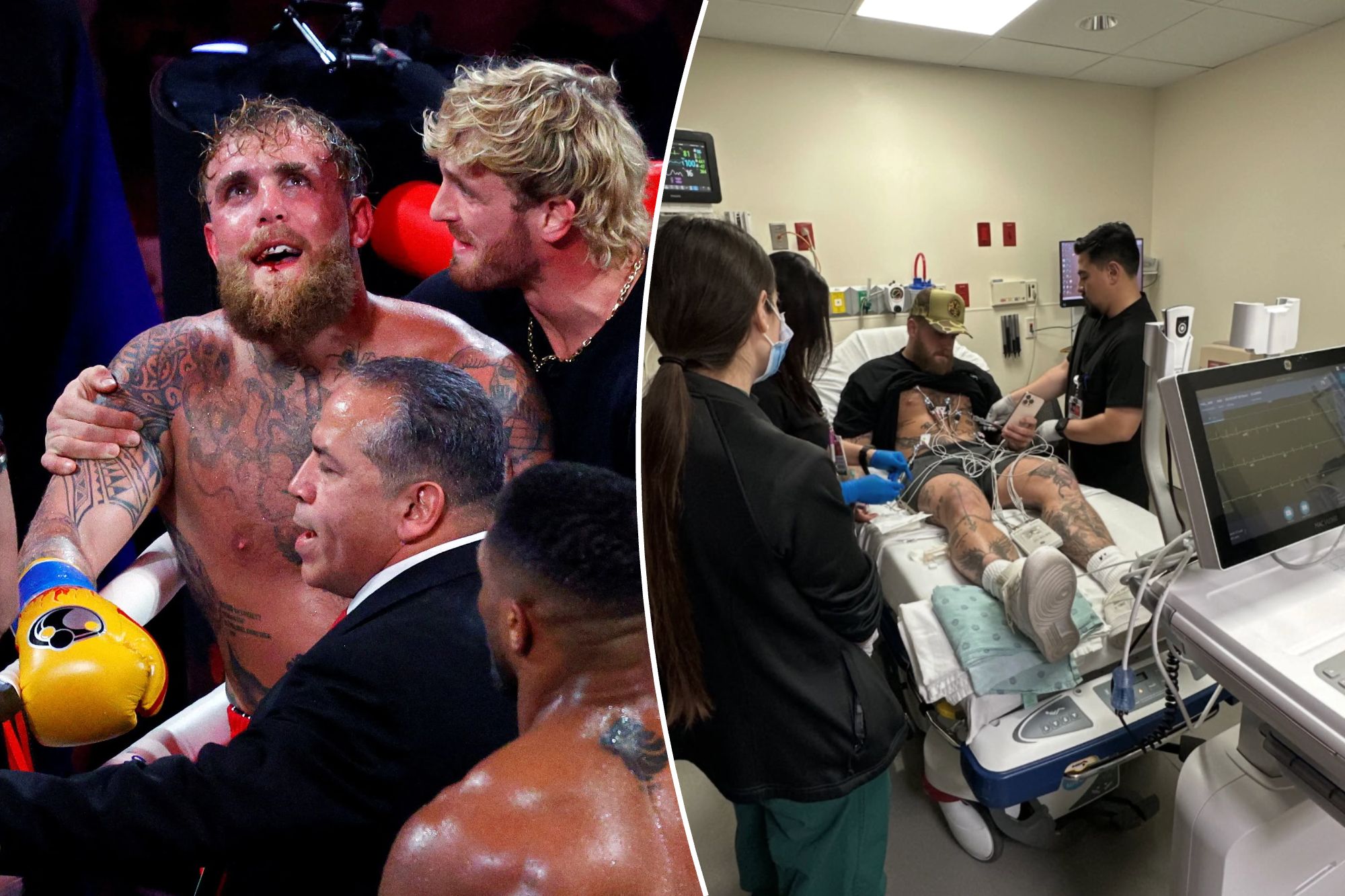 Jake Paul undergoes second surgery for broken jaw from hyped Anthony Joshua bout<br><br>
