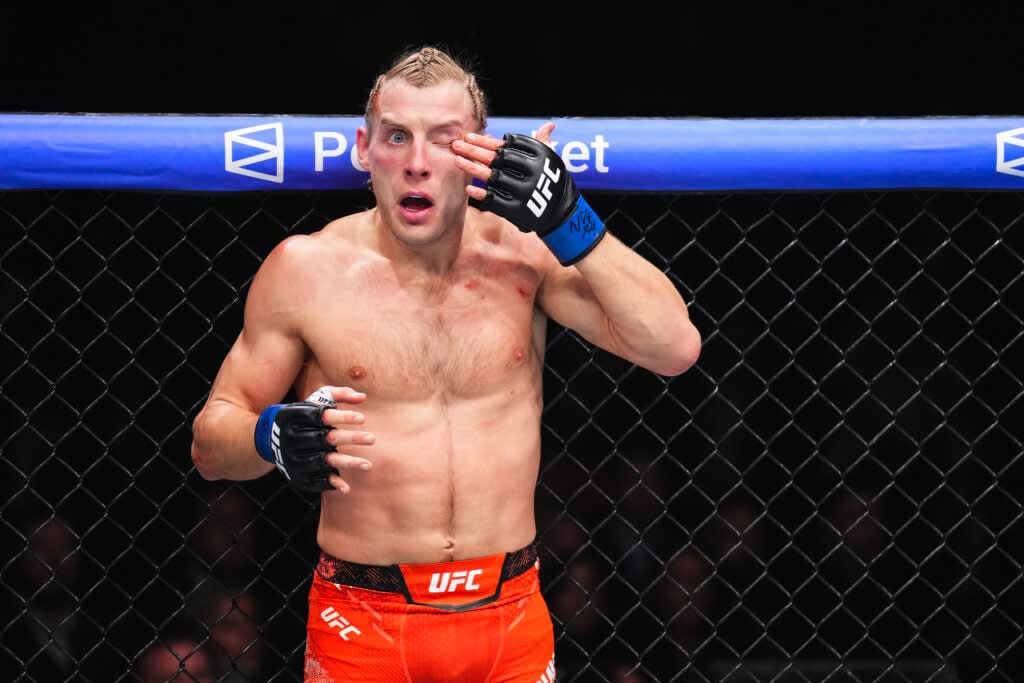 Paddy Pimblett’s manager reveals crucial details about UFC star’s recovery<br><br>