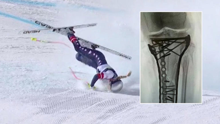 Vonn richtet sich an Hater: "Ich habe alles gewonnen"