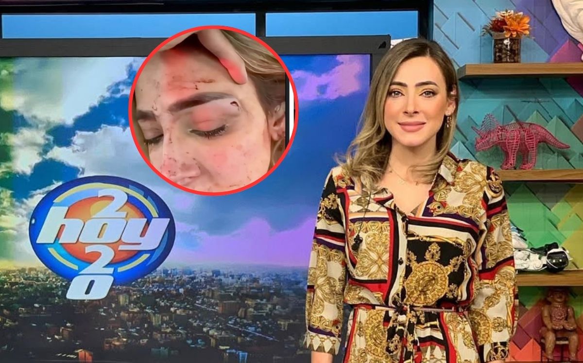 Edna Monroy denuncia agresión de su expareja; difunde audios y fotos de ...