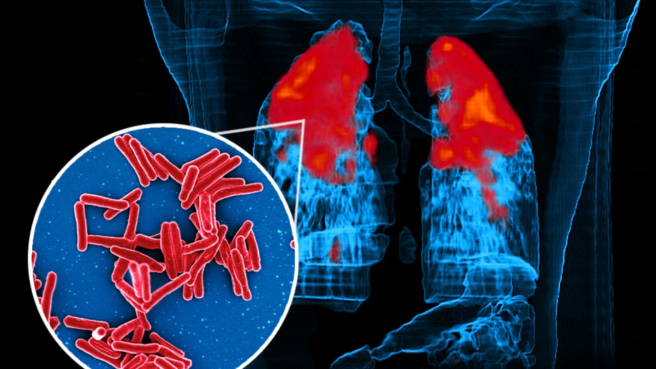 How TB bacteria use stealth tricks to slip past your immune system?