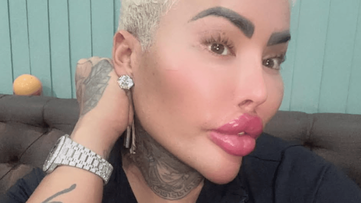 Who is Jordan James Parke? Family heartbroken as ‘Lip King’ influencer dies