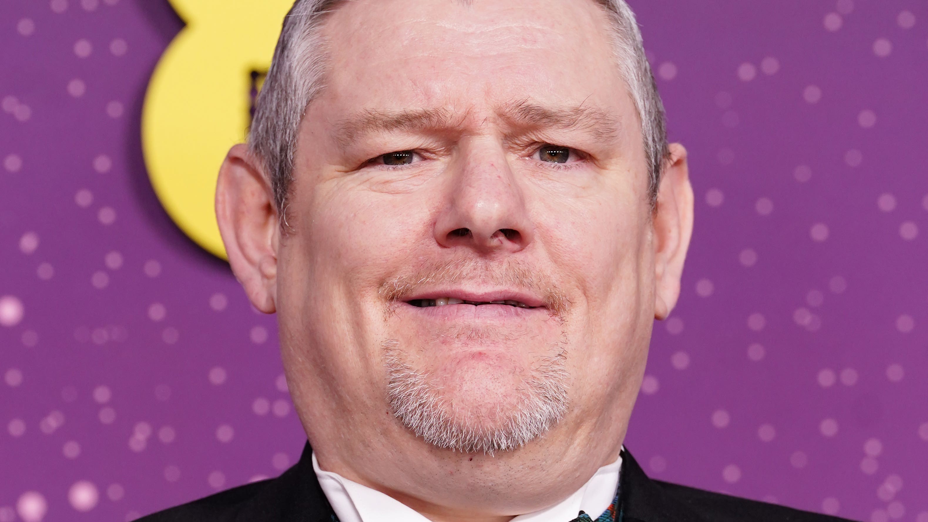 BBC apologises for not editing racial slur out of Bafta Film Awards ...