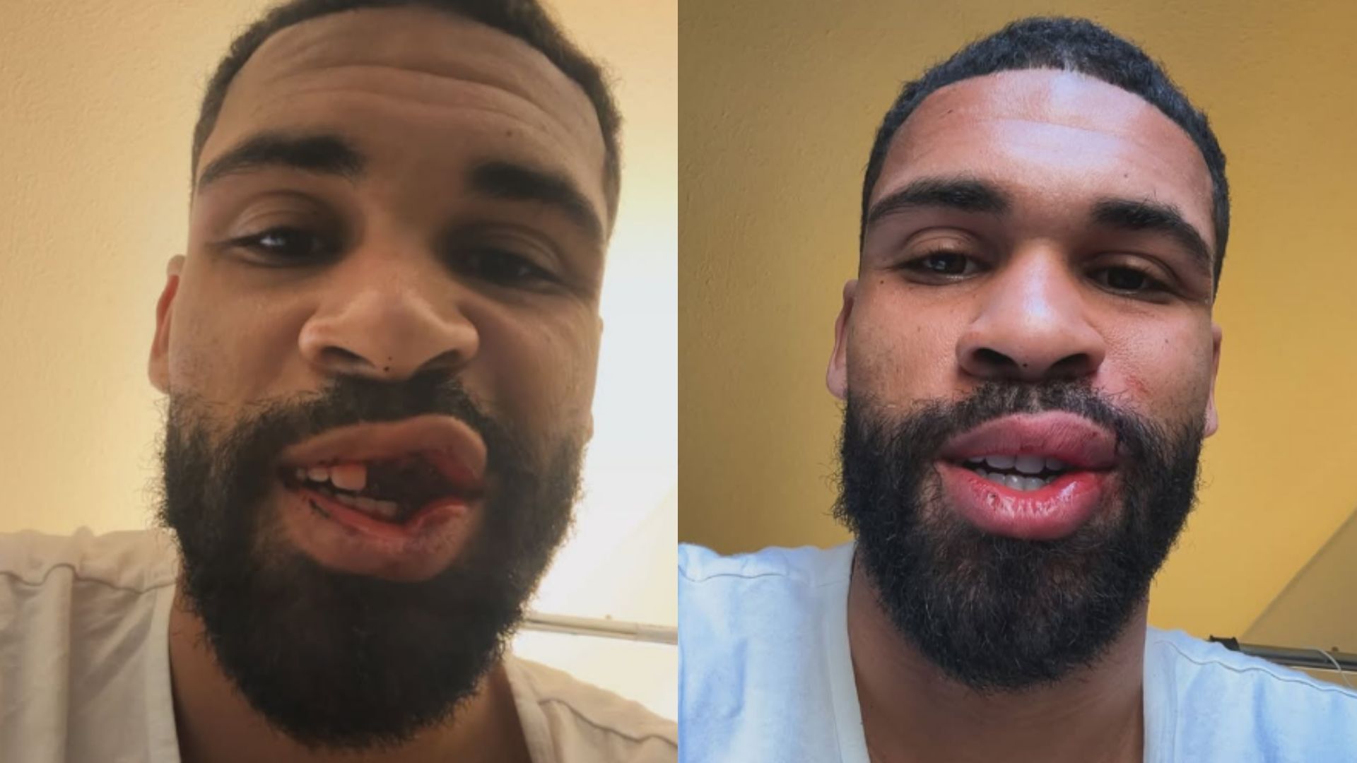 ac-milan-star-ruben-loftus-cheek-reveals-gruesome-injuries-after